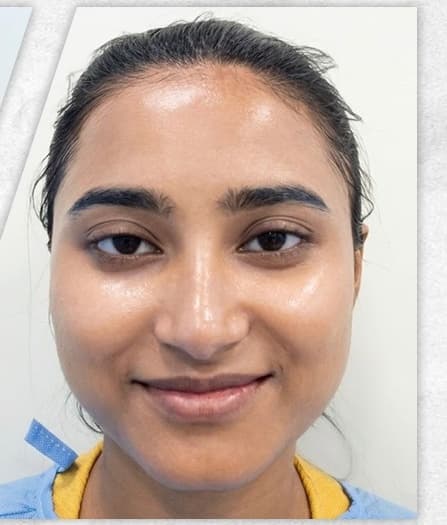 Instant Glow Facial — after
