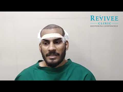 Hair Falls & Hair Loss | Revivee Clinics | Girish Park