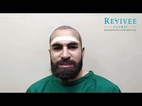 Patient Testimonial | Hair Fall & Hair Loss | Revivee Clinic